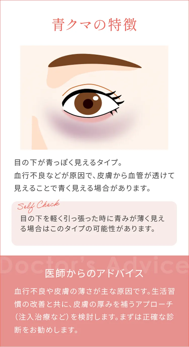 青クマの特徴