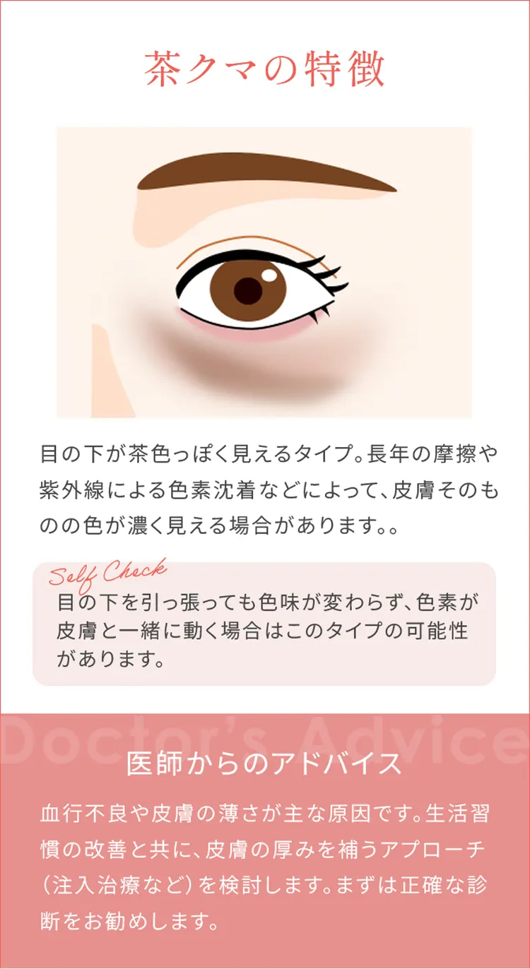 茶クマの特徴