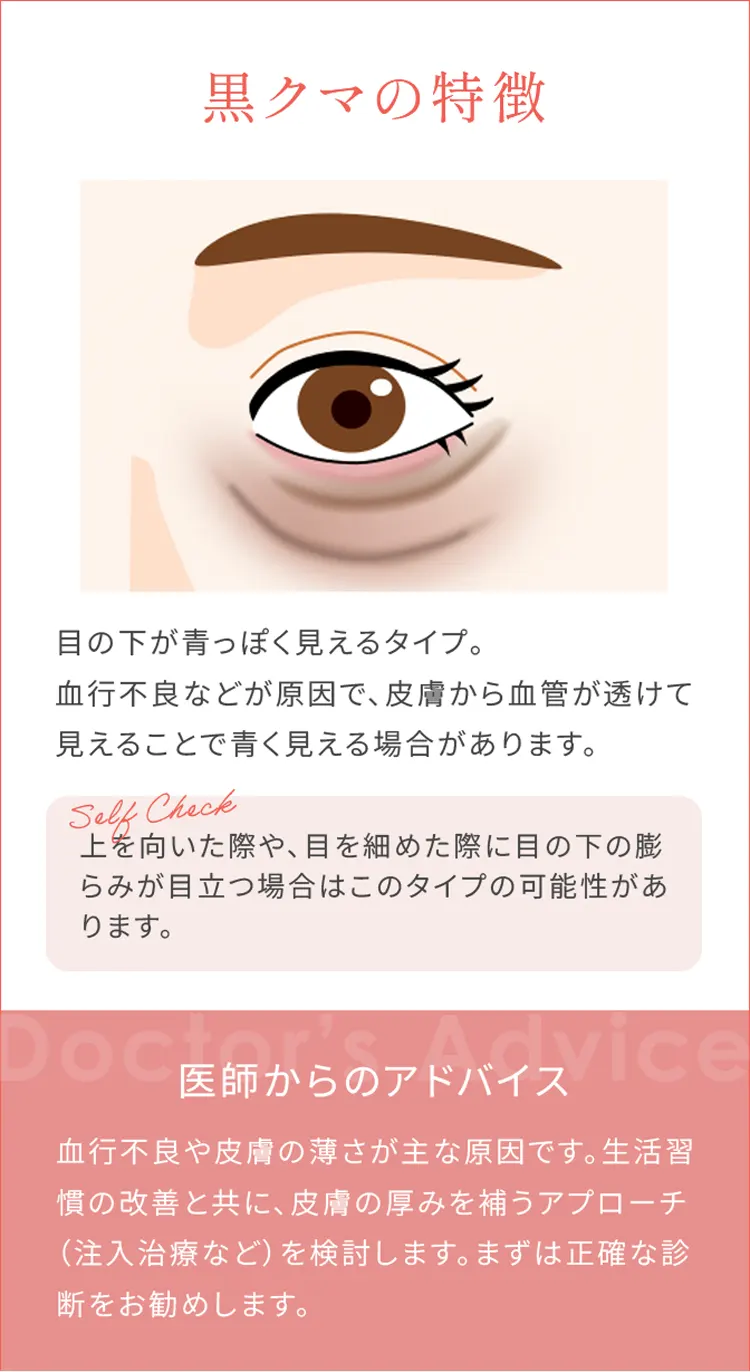 黒クマの特徴