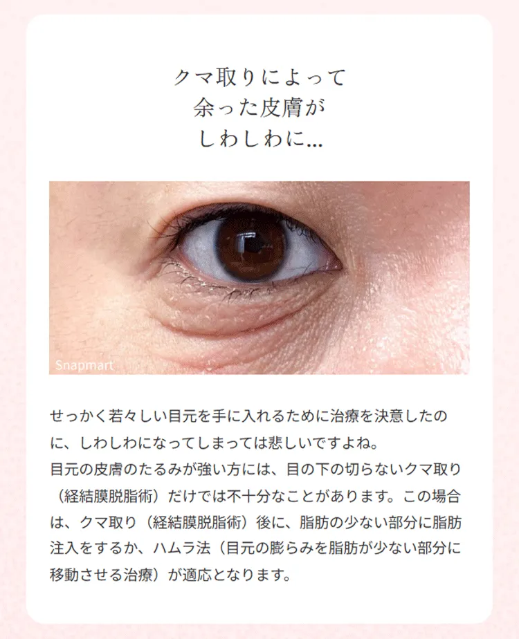 画像の説明文を入れてください