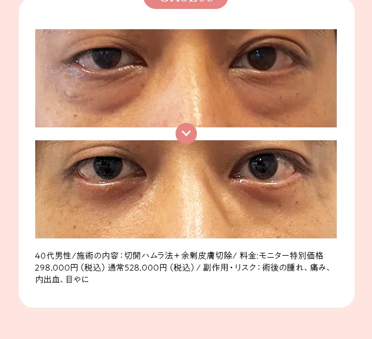画像の説明文を入れてください