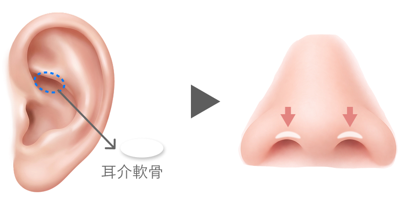 中等症例