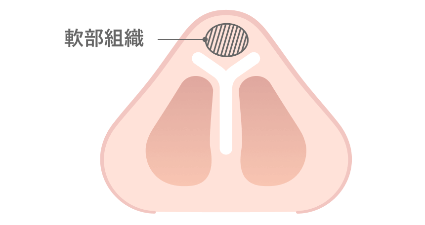 余分な脂肪や組織の除去