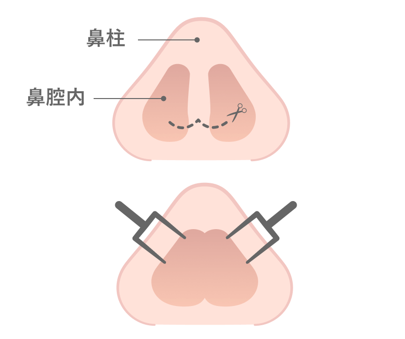 オープン法