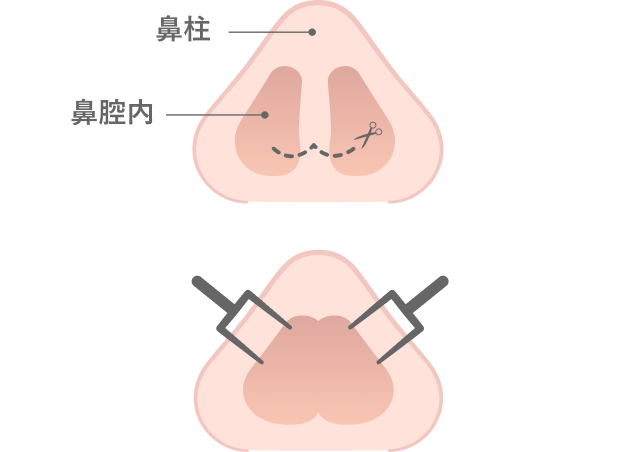 オープン法