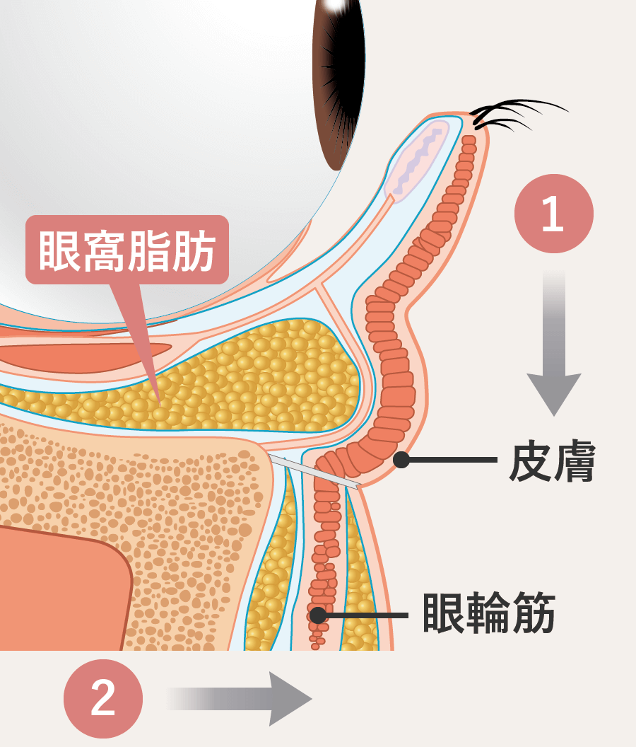 目の下のクマ・たるみの原因