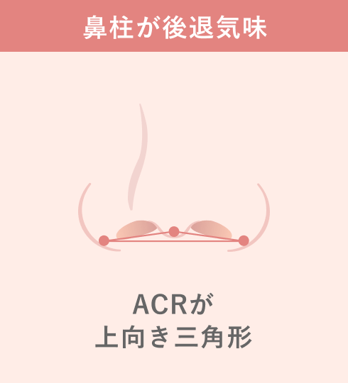 小鼻と鼻柱の関係（ACR）