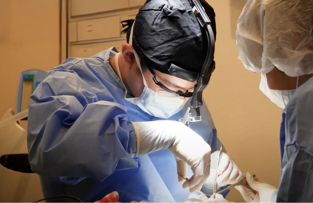 Rhinoplasty surgery
