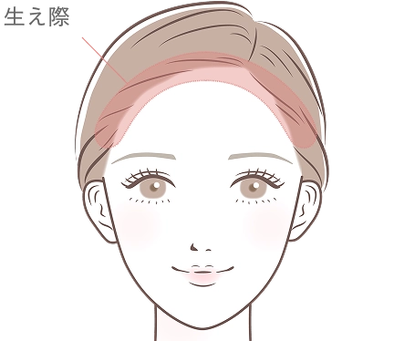 ヘアライン
