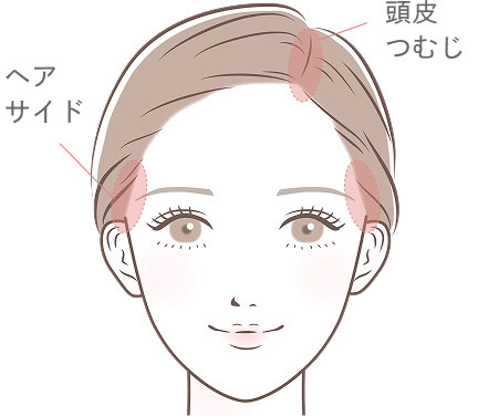 ヘアサイド・頭皮