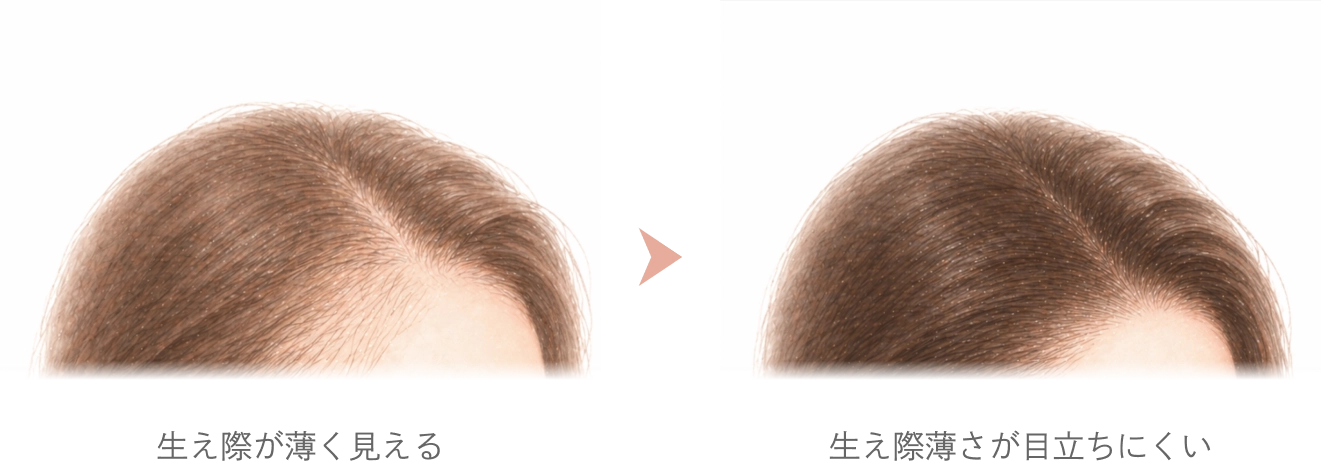 ヘアライン