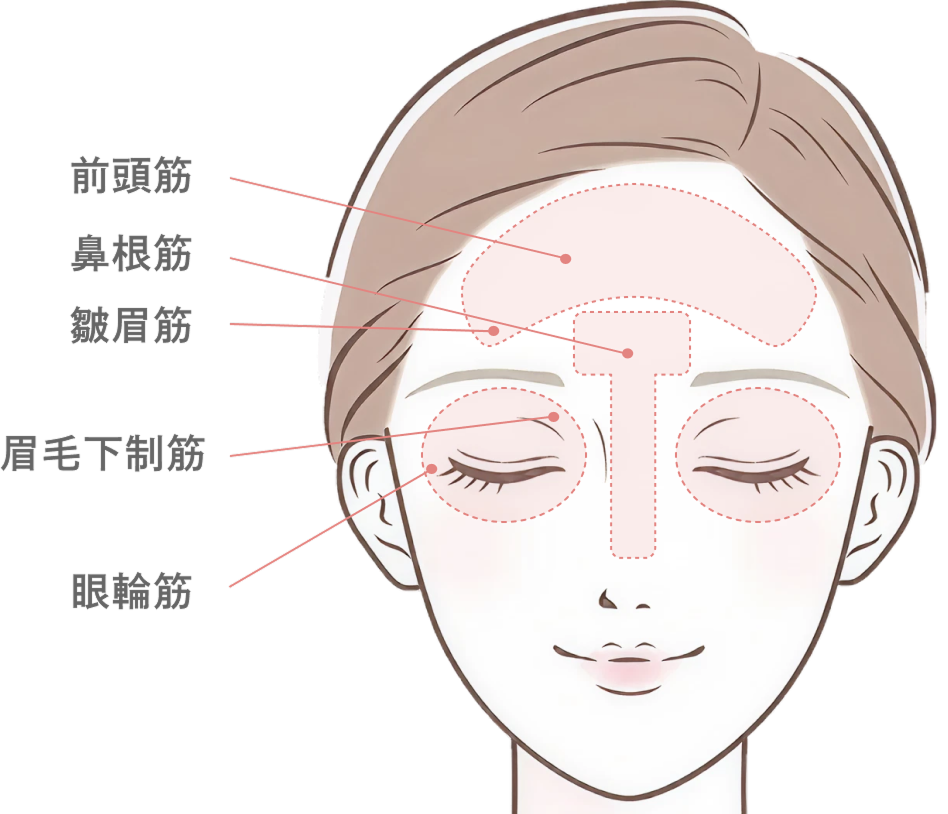 額・眉間・バニーラインのボトックス注射とは