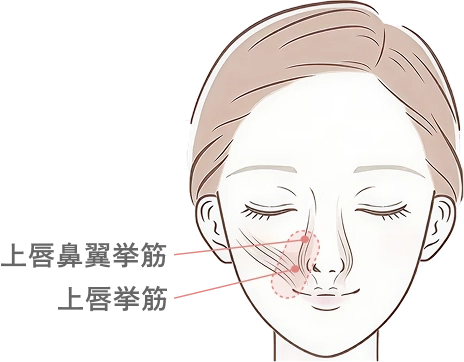 ガミースマイルのボトックス注射とは
