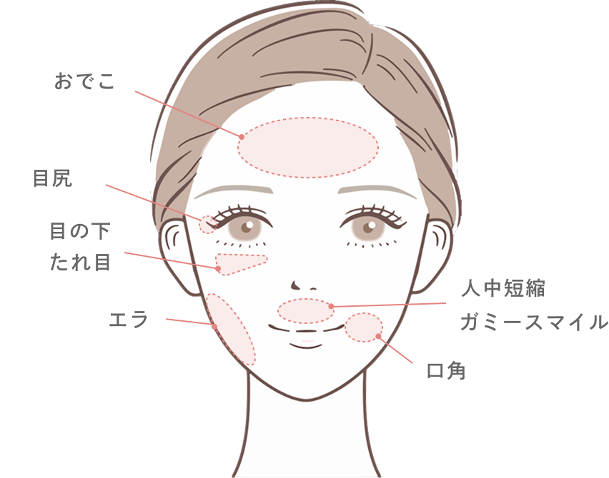 ボツリヌストキシン治療