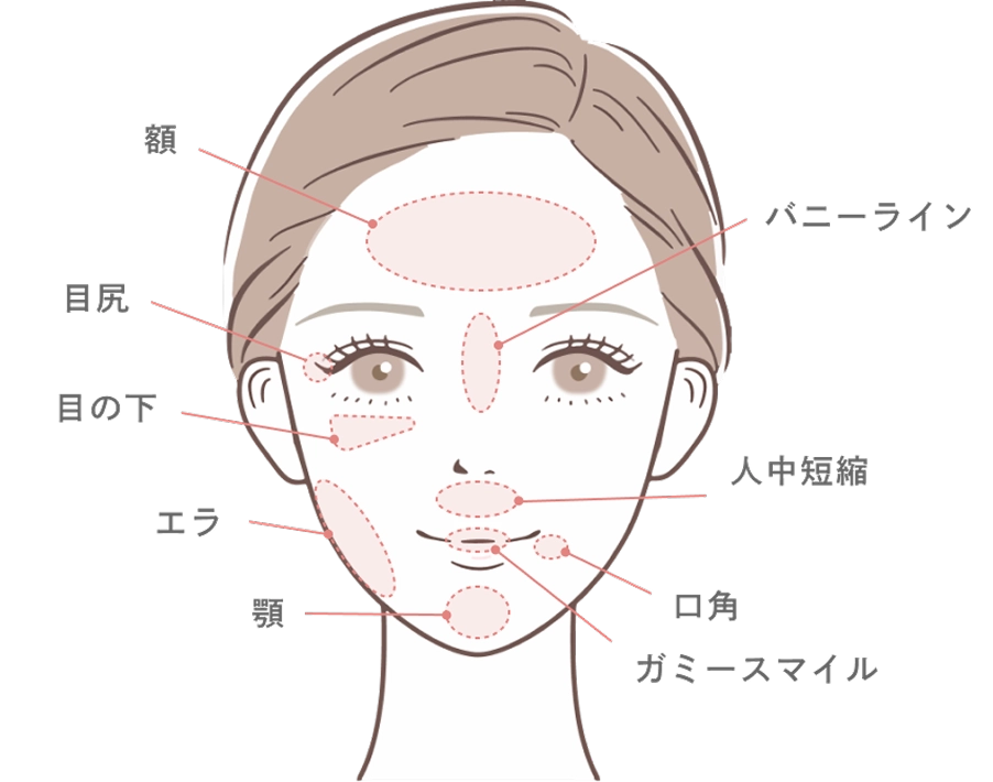 ボツリヌストキシン治療