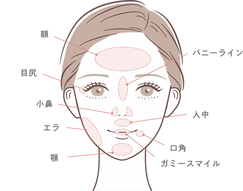 ボツリヌストキシン治療