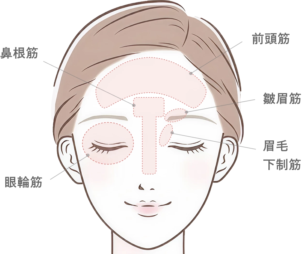 額・眉間・目尻のボトックス注射とは
