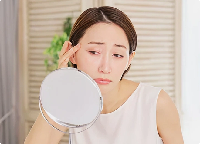 額・眉間・目尻にシワができる原因