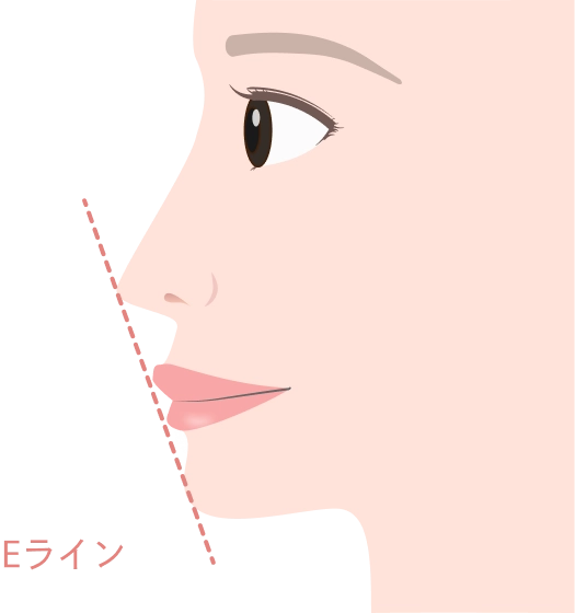 理想的なEラインとは