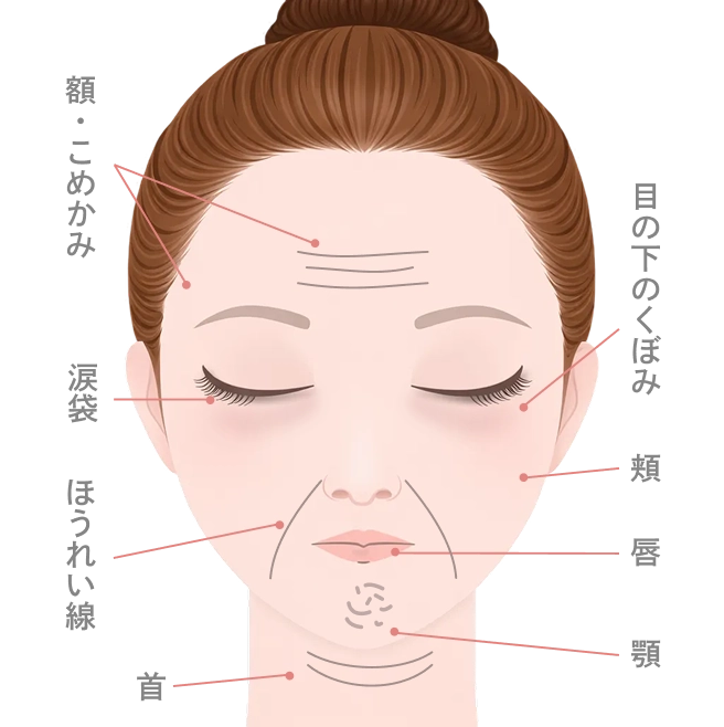 ボツリヌストキシン治療