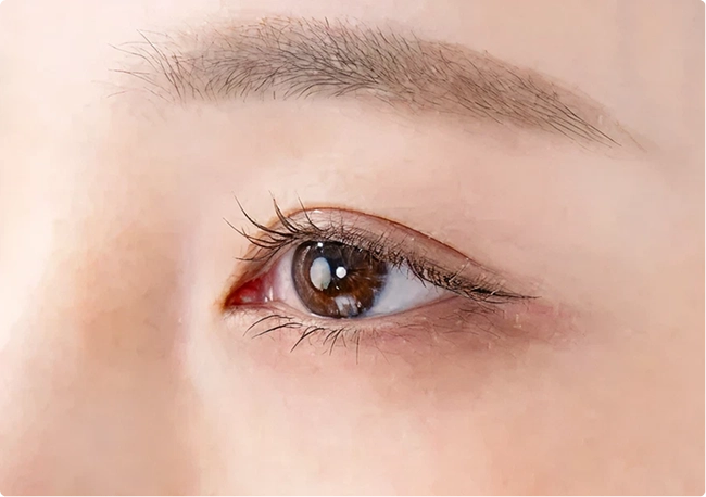 目が小さく見える原因