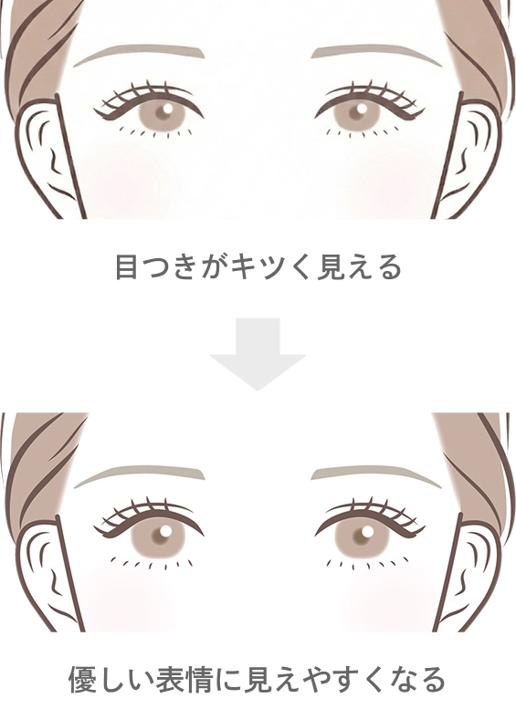 目デカボトックス注射の効果