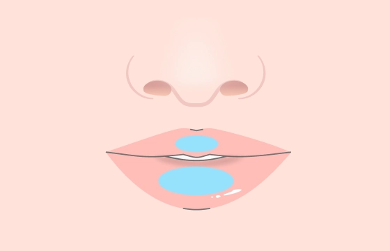 ボリュームアップ