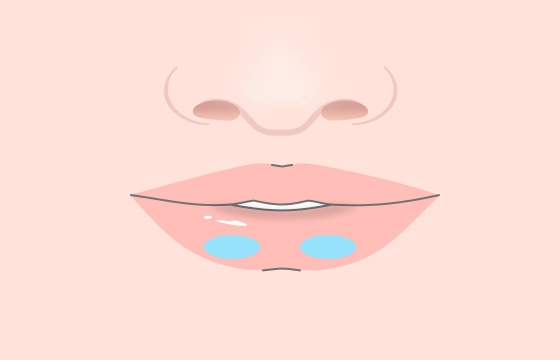 ボリュームアップ