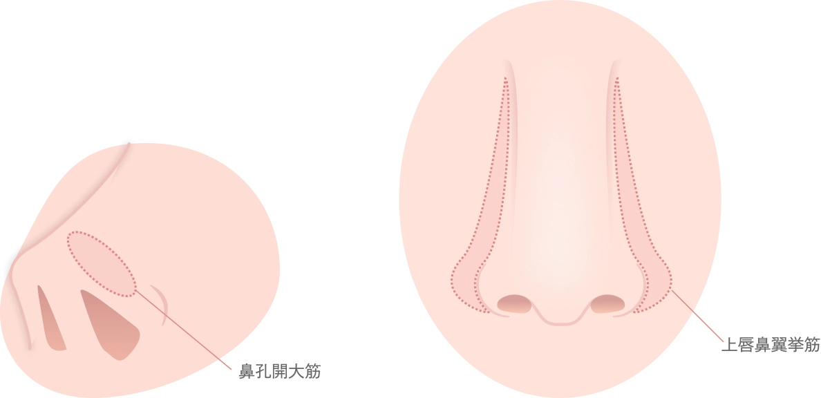 小鼻のボトックス注射とは