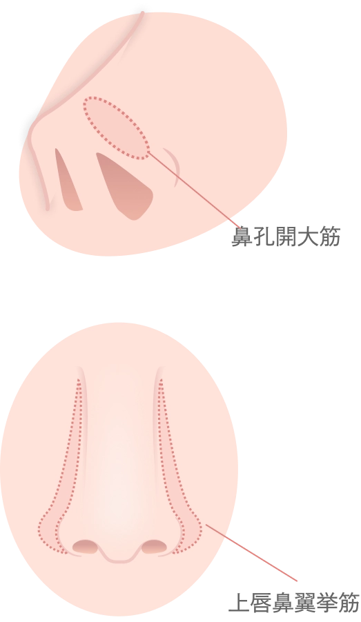 小鼻のボトックス注射とは
