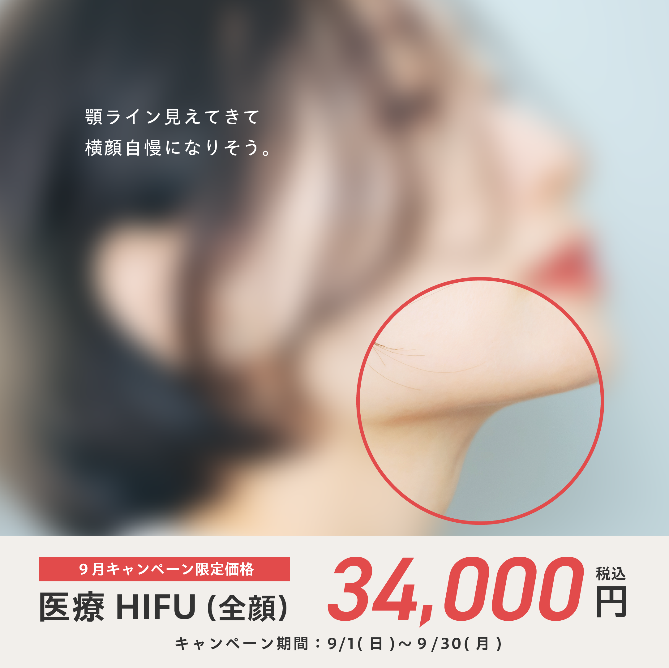 9月HIFU