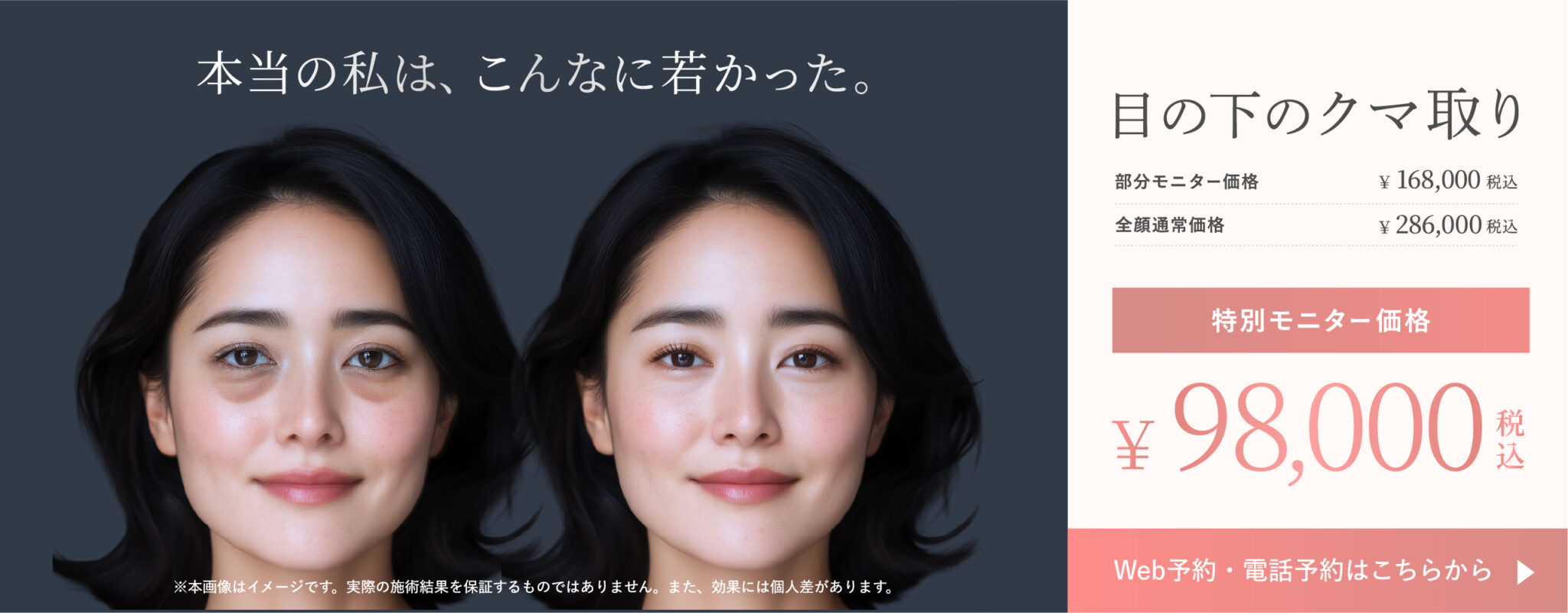 8月クマ取り