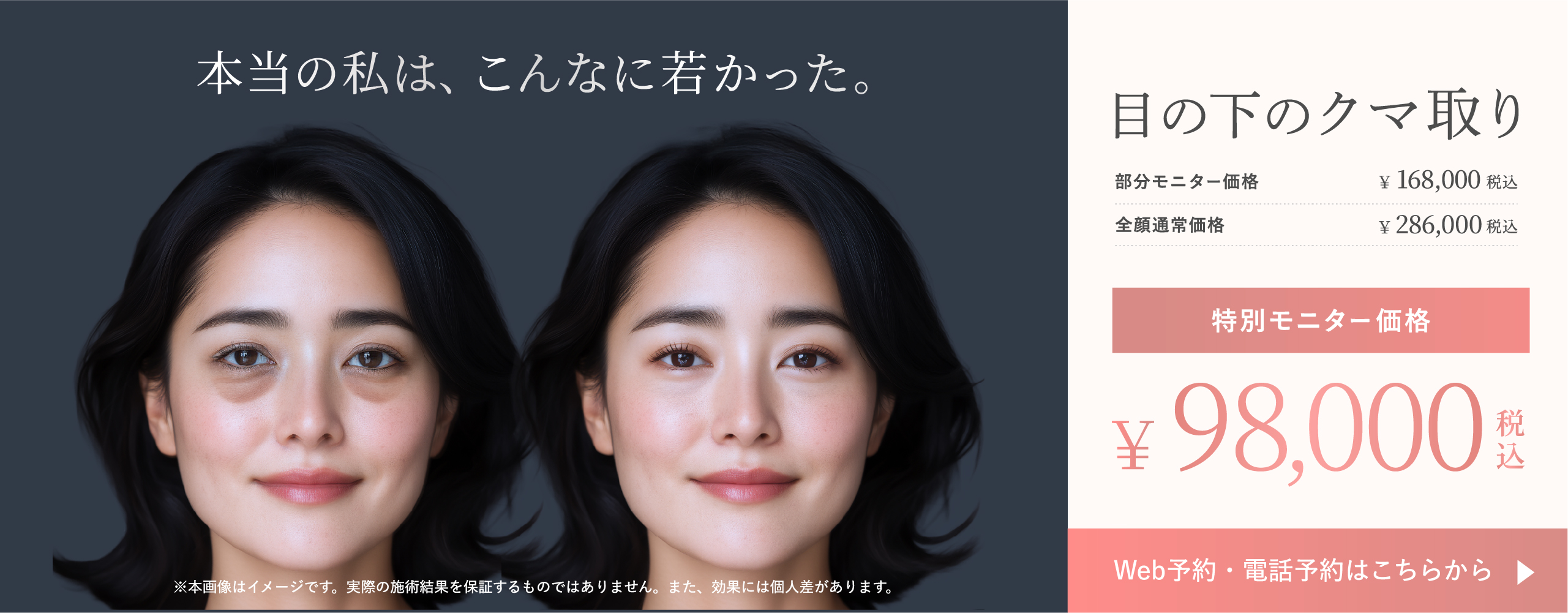 8月クマ取り