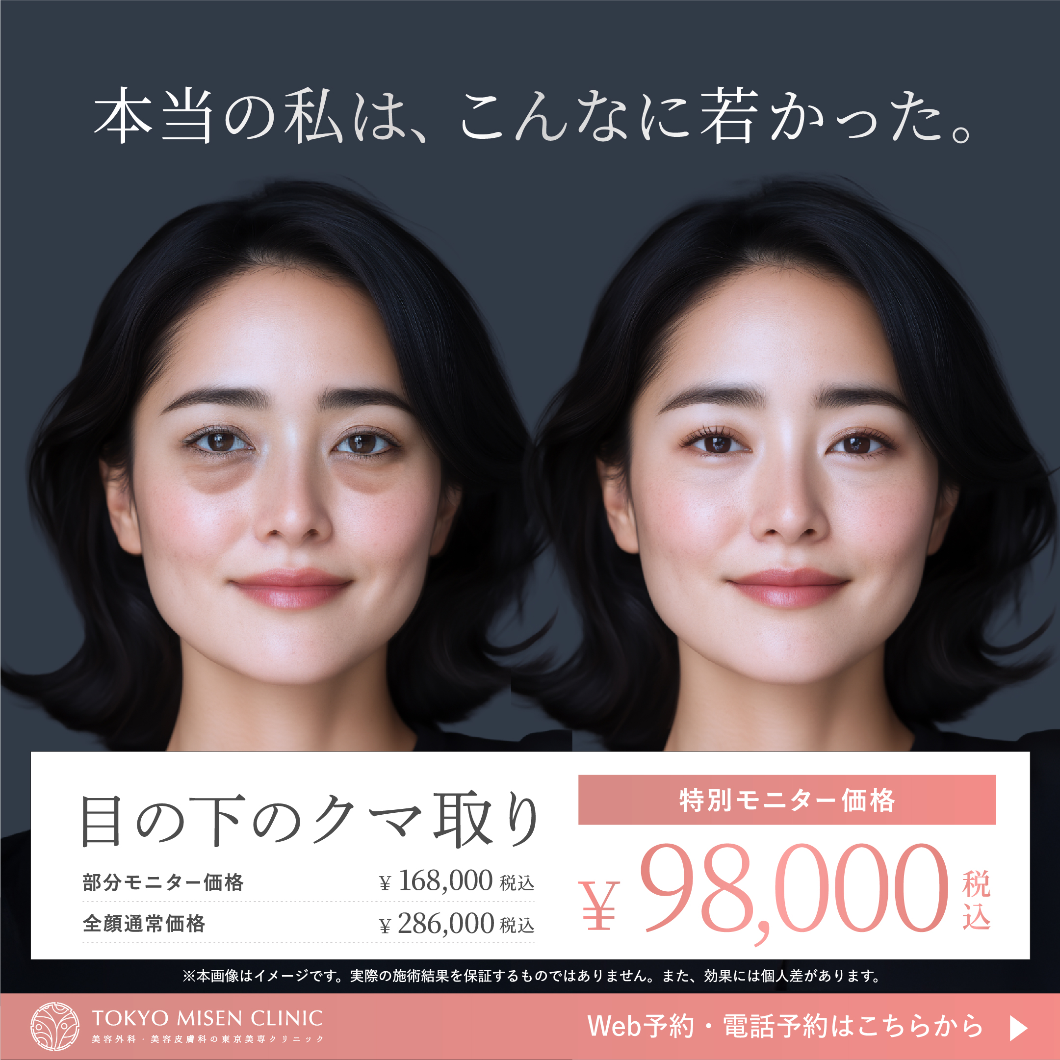 8月クマ取り