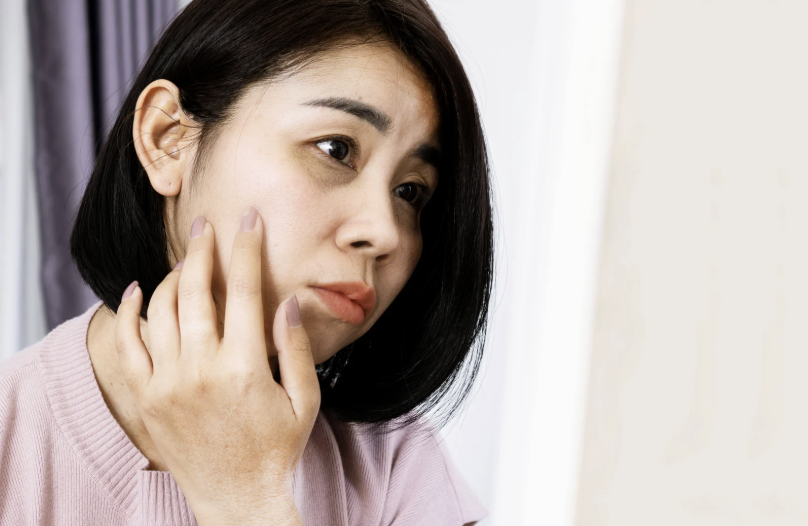 クマ取りとヒアルロン酸注入の違い｜あなたに向いているのはどっち？