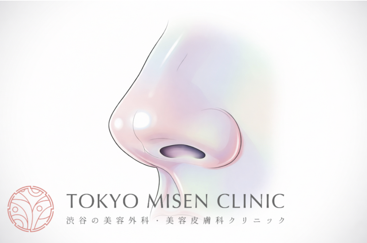 鼻翼挙上とは？向いている人の特徴・ダウンタイム・失敗を防ぐ注意点を徹底解説